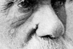 Darwin's wen